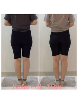 スタイルラボ高松/産後骨盤矯正の効果♪