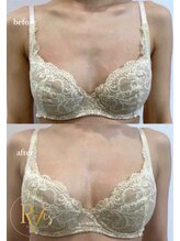 ラヴィス(RAVIS)/痩せ型でも胸が育つ！