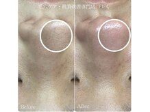 ピエル 北千住店(PIEL)/3回目のお客様