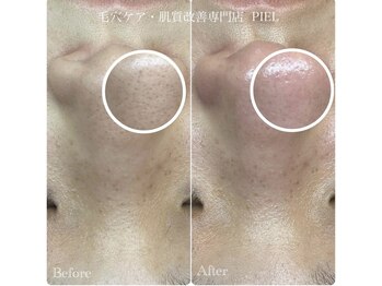 ピエル 北千住店(PIEL)/3回目のお客様