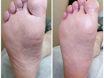 リゼラアンドコー 浦安店/ドイツ式フットケア専門店