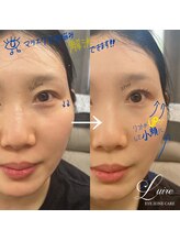 ルイール 光の森(Luire)/熊本光の森LEDマツエク/ブラウン