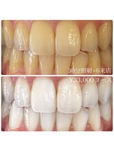 ホワイトニングルーム 川崎店(WhiteningRoom)/ホワイトニング/川崎　