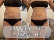 ラシク 吉祥寺(LACHIC)/ぽっこりお腹