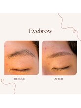 オルテンシア(Hortensia)/眉毛ワックス脱毛