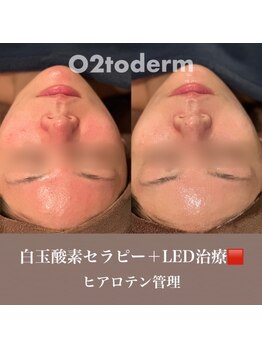 ウィルビューティーサロン(will beauty salon)/