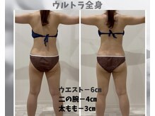 フルーア(FULUA)/ウルトランスフォーマー全身