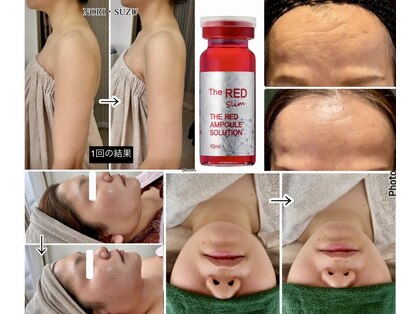 ノリスズ(NORI SUZU)の写真