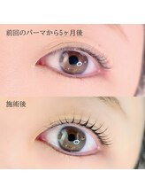 ヒロノヒガシヤマ(HIRONO higashiyama)/カール