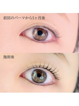 ヒロノヒガシヤマ(HIRONO higashiyama)/カール