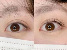 アンドアイズ(And Eyes)/マツパ／ビフォーアフター