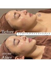 ミエル 神戸店(Miel)/リアボーテタラソトリートメント