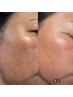 【もやもやジミケア・強美白】　最新フォトで気になるもやっとジミ改善