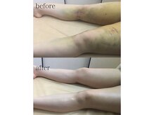 シルクドリバー 大阪店(Silk de River)/インディバ