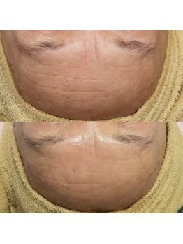 ナチュラリー(Naturally)/エステ/リラク/狭山ヶ丘/所沢