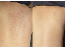 ジュエリーボディー(Jewelry body)/