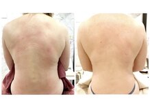 ビノスビューティー(vinos.beauty)/上半身　痩身