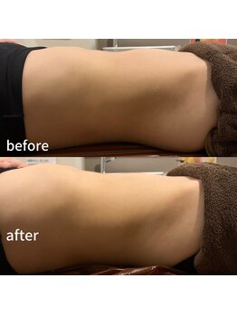 ラルーチェ(LaLuce)/腸リンパ