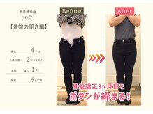 ココア 春日井店(cocoa)/整体&産後骨盤矯正&痩身/春日井