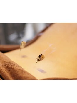 鍼灸施術を受けたい