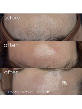 ループラス 中目黒(r'oo plus)/フェイスワックス