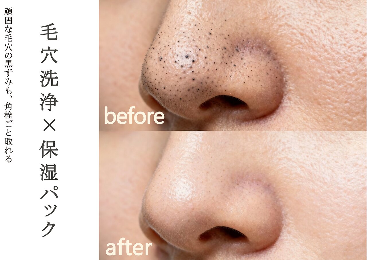 イニジアエリート 池袋店(inizia elite)｜ホットペッパービューティー