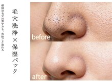 リブナス(Livnus)