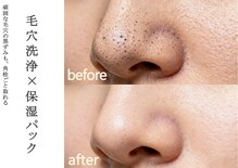 イニジアエリート 池袋店(inizia elite)