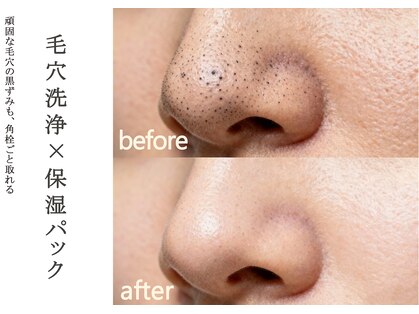 リブナス(Livnus)の写真