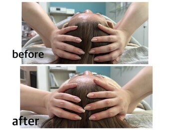 エクラニーク(Eclanique)/小顔ケアで頭のほぐしも行います