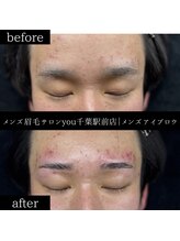 ユー 千葉駅前店(you)/ビフォ－アフター写真