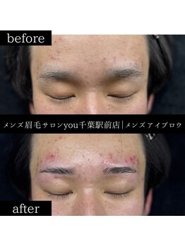 ユー 千葉駅前店(you)/ビフォ－アフター写真
