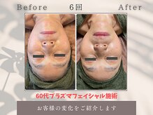 トータルビューティー雅/60代もっと変われます！