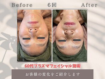 トータルビューティー雅/60代もっと変われます!