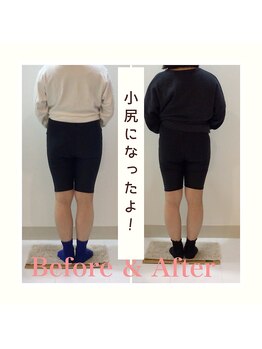 スタイルラボ高松/産後の骨盤矯正の効果♪