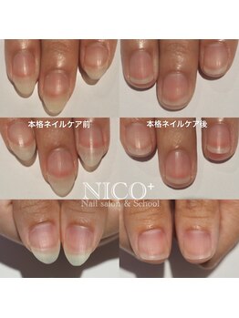 ニコプラス(NICO+)/ジェルネイルができない方向け