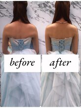 ラグラン銀座メディカルエステ 高輪ゲートウェイ店/ブライダル＃プレ花嫁のお客様