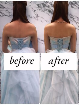 ラグラン銀座メディカルエステ 高輪ゲートウェイ店/ブライダル#プレ花嫁のお客様