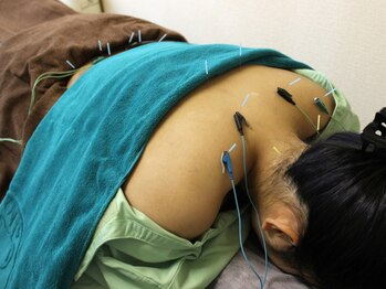 いなほ はりきゅう整骨院 東新宿/鍼灸(吸い玉併用)コース