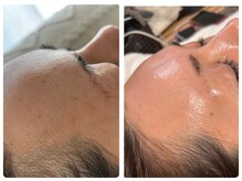 ベルドア(Bell Door)/蘇るハリツヤ弾力　40代