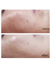 ナチュラリー(Naturally)/エステ/リラク/狭山ヶ丘/所沢