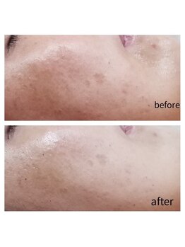 ナチュラリー(Naturally)/エステ/リラク/狭山ヶ丘/所沢