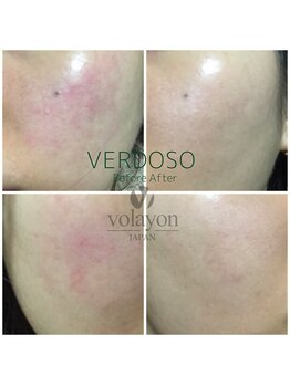 ウィルビューティーサロン(will beauty salon)/