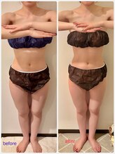 フーガ 宇都宮店(fu-ga)/やみつき 美骨リンパマッサージ