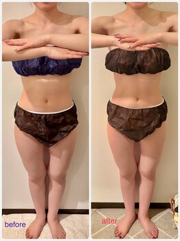 フーガ 宇都宮店(fu-ga)/やみつき 美骨リンパマッサージ