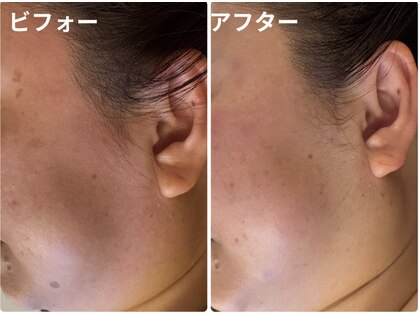 エステティックサロン アヤ(aya)の写真