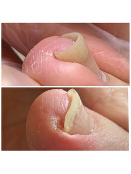 リネイル 長浜(Re-na-iL)/ネイルケア＆スパ¥7000