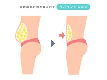 シュシュ(chouchou)/リバウンドなしの痩身