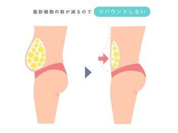 シュシュ(chouchou)/リバウンドなしの痩身