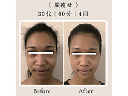 インディバ ホリ ナゴヤ ハニーズビューティー(INDIBA HORI NAGOYA Honey’s beauty)の写真